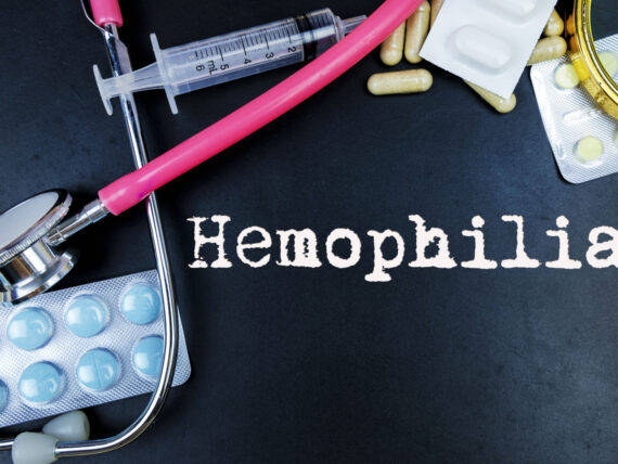 5 Common Symptoms of Hemophilia