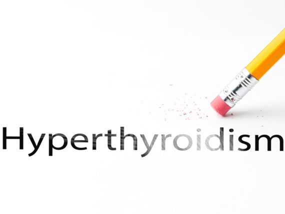 6 Eye Signs of Hyperthyroidism